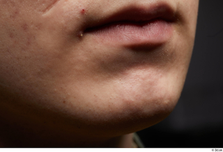 HD Face Skin Casey Schneider chin face lips mouth skin…